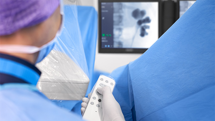 Arcos en C móviles para gastroenterología/urología