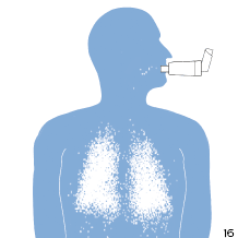Inhalador con c&aacute;mara